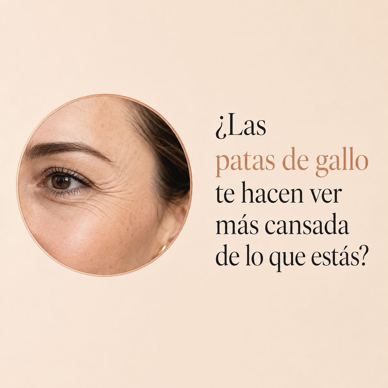 Arrugas alrededor de los ojos